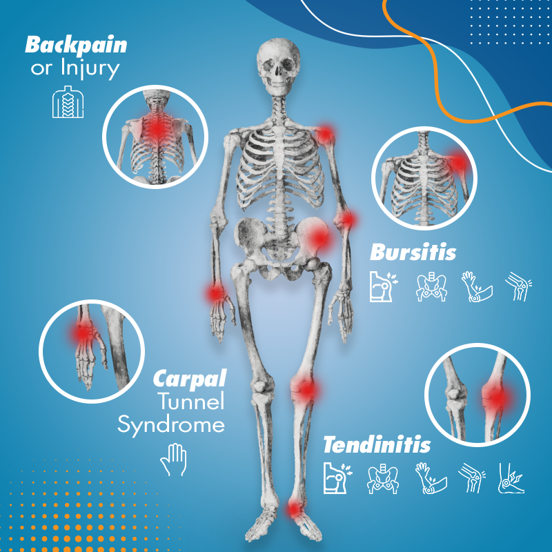 Skeleton Diagram Showing Different MSDs Caused by Improper Ergonomics